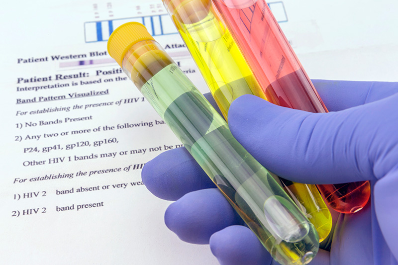 Laboratórios referência para Corona Vírus